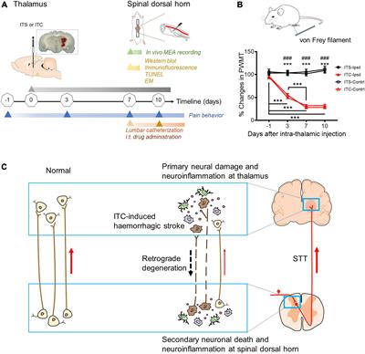 Secondary damage and neuroinflammation in the spinal dorsal horn mediate post-thalamic hemorrhagic stroke pain hypersensitivity: SDF1-CXCR4 signaling mediation